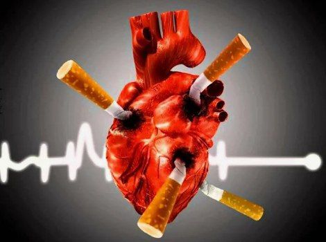 � ���� �������� ��������� ���������߻?